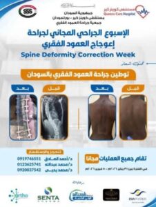 مجانا بالكامل.. فرصة العمر لهؤلاء المرضى في بورتسودان بدءا من الغد